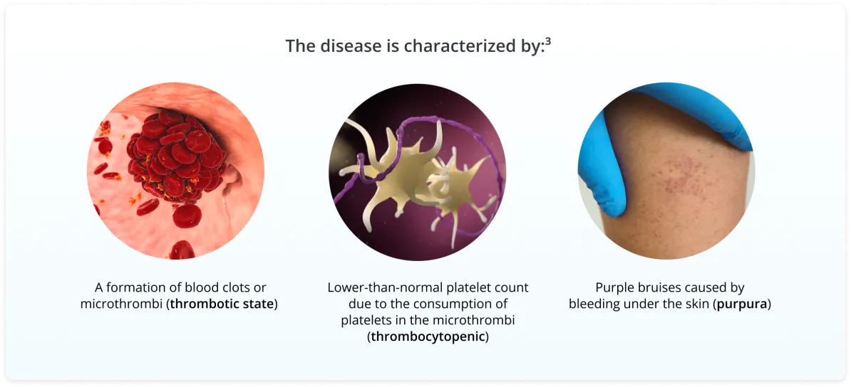 Row of three circular images and text. One image is of red blood cells, the next, platelets, the third is bruised skin