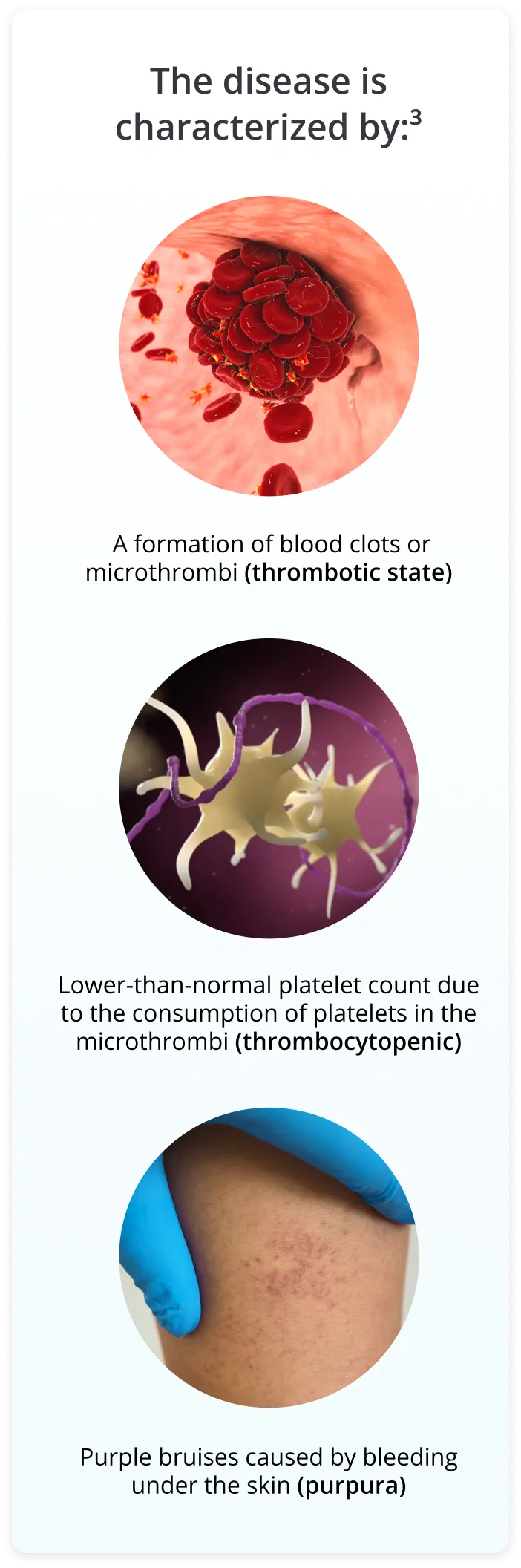 Row of three circular images and text. One image is of red blood cells, the next, platelets, the third is bruised skin