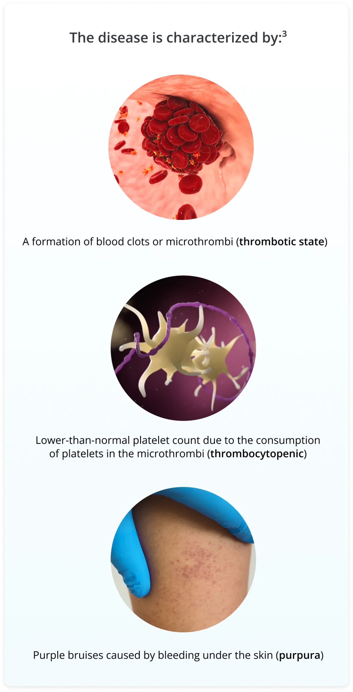 Row of three circular images and text. One image is of red blood cells, the next, platelets, the third is bruised skin